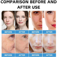 Vitamin B5 Repair Face Serum Cream,Skin Barrier Repair Cream,B5 Cre-am,Hydrating Cre-am,Skin Firming Butter,Restore Luster,Restore The Damaged Sk-In,Face Moisturizer For Women &Men And Sensitive