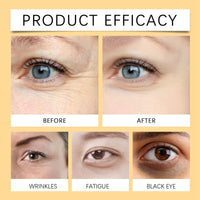 OuXing Eyelift Serum Mango Revitalize Eye Cream,eye cream for dark circles and puffy eyes,Hyaluronic Acid Repair Cream,eye bag crea-m,Wrinkles Eye Creams Oil Essence Firming Crea-m,eye tightening cre-am