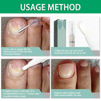 2 Pack Nail Repair Pen, 4ml Nail Care Liquid - Nail Strengthener, Cuticle Oil, Help Strengthen The Nails