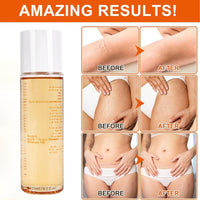 IZBEAUVO Body Skin Care Oil, Stretch Mark & Scar Oil for Women, Stretch Marks Removal Skin Regenerating Body oils, Skin Regenerate oil with Chamomile, Vitamin E, Lavender Improves Elasticity 125ML