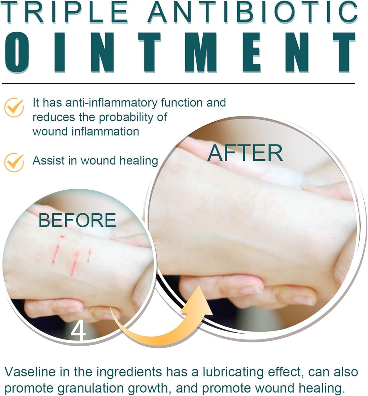 Quellora Wound Healing Ointment, Relieve Skin Abrasions, Promote Wound Healing, Fade Scars
