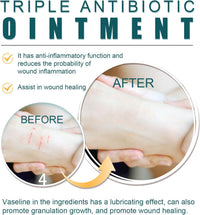 Quellora Wound Healing Ointment, Relieve Skin Abrasions, Promote Wound Healing, Fade Scars