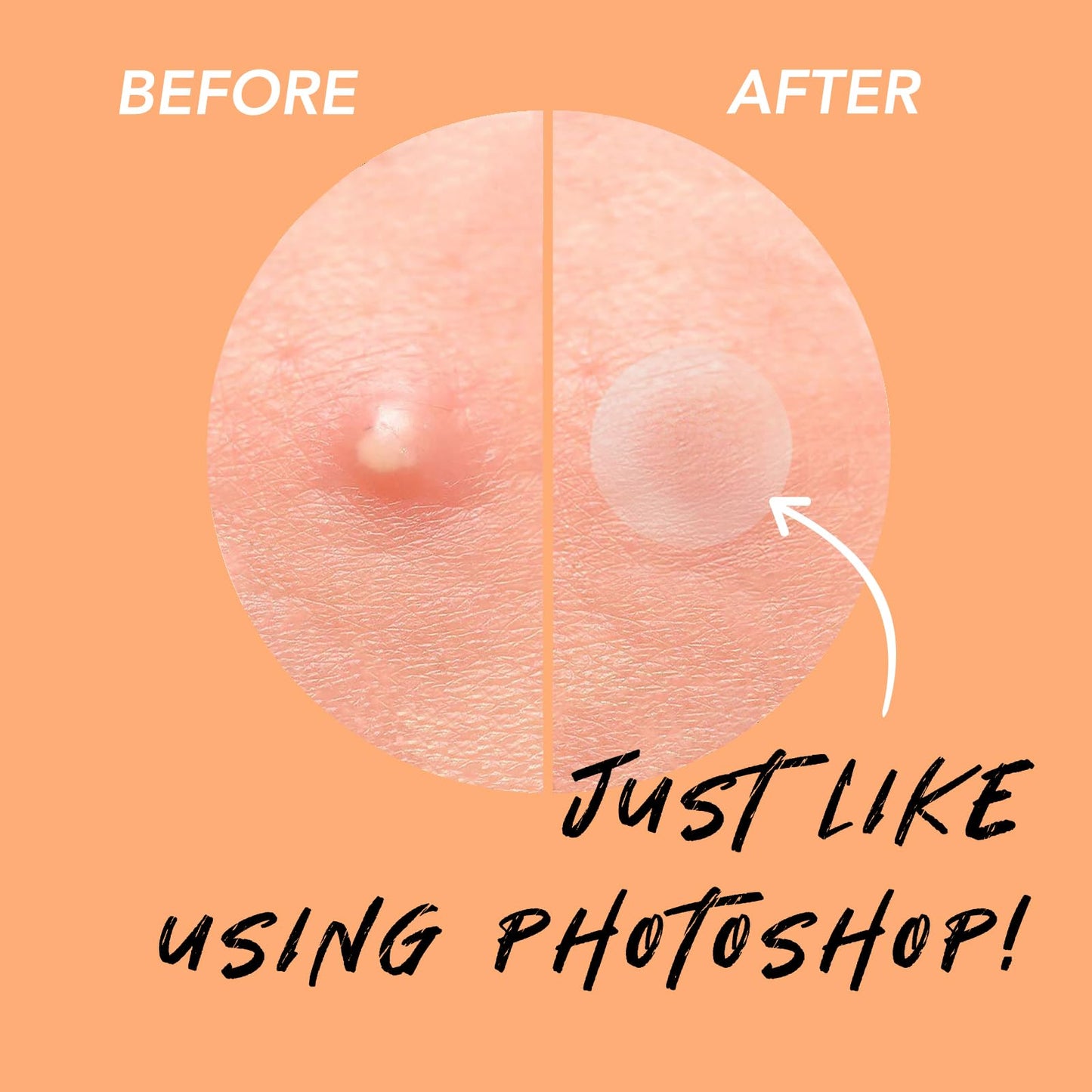 Spot Pimple Patches Aliobio Invisible Blemish Spot Cover Facial Sticker Hydrocolloid Patch Acne Stickers Spot Stickers with Two Sizes orange, 216 Count