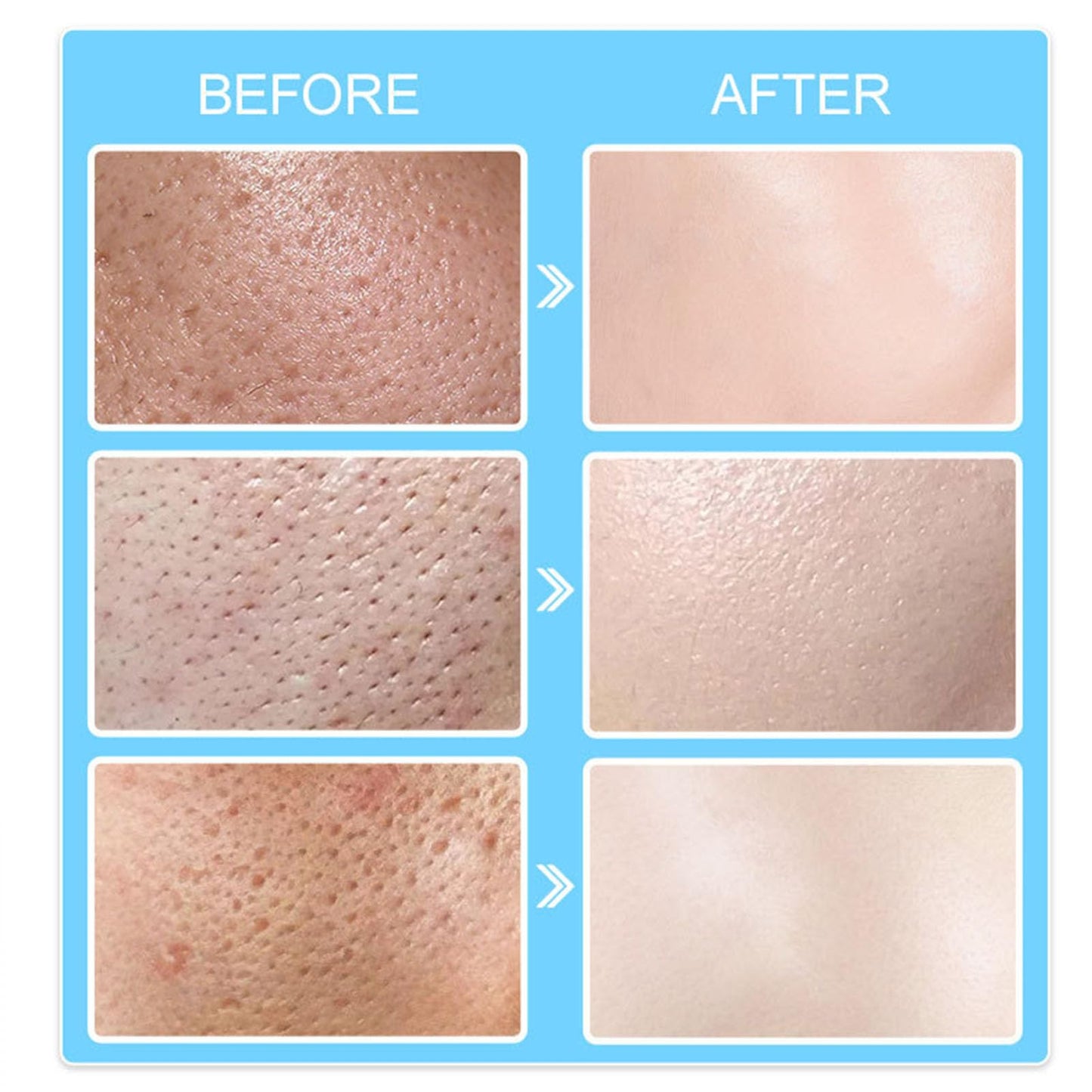 Pore Invisible Cream,Pore Shrinking Invisibility Cream,Pore Minimizer & Reducer for Face,Oil Control Firming,Tightening Pores,Moisturizing,Lightens Fine Lines Conceals Pores Cream