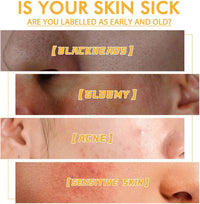 Honey Peel-Off Mask for Blackhead Removal & Pore Minimizing - Deep Clean Tearing Mask with Natural Propolis, Oil Control & Dead Skin Exfoliator, Reduces Wrinkles for Face Care