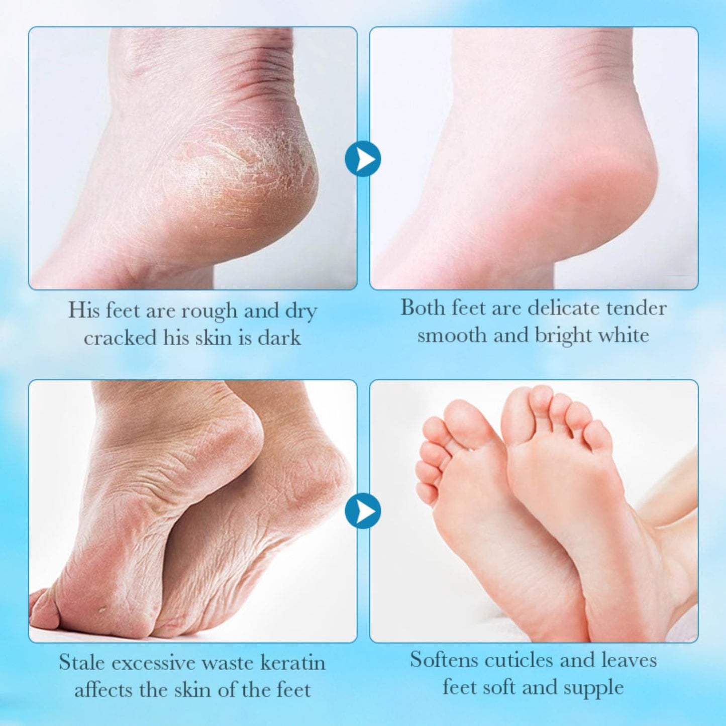 ISBEAUSOLS 3pcs 98% Aloe Extract Foot Peel Mask - Nourish Foot Mask - Soothing and Soften Hard Foot - Foot Moisturiser Socks for Dry Foot - Daily Foo Care,Moist Exfoliator,Improve Darkness