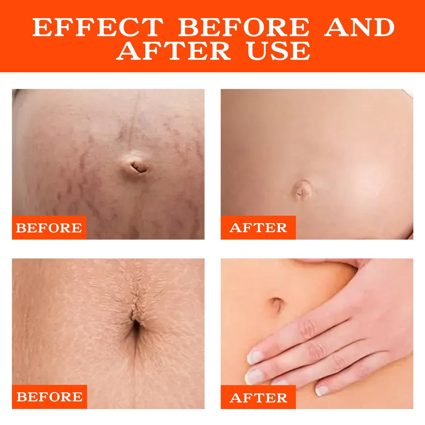 PlusBee Bio Oil Scar Treatment, Collagen Boosting Oil for Scars, Stretch Marks & Uneven Skin Tone, Skincare Serum for Pregnancy, Acne & Surgery Scars, 125ml