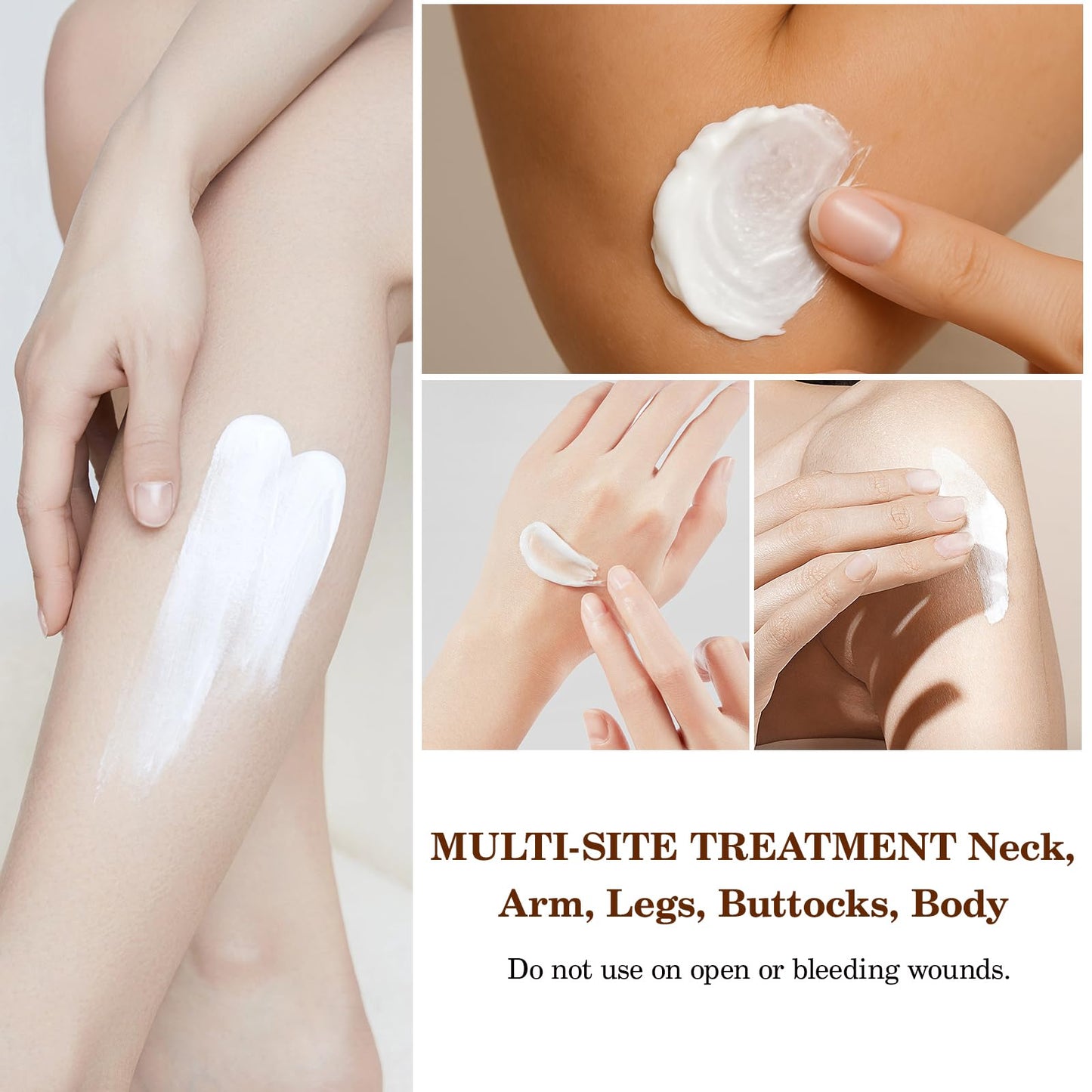 Strawberry Legs Treatment Cream, Skin Smoothing Cream for Chicken Skin Treatment, Fades And Eliminates Strawberry Spots, Exfoliating, Moisturizing, 4.21FL.OZ
