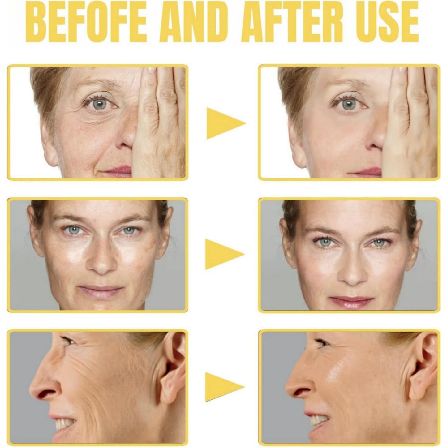 Haiyox Frankincense Resin Oil For Face,Frankincense Resin Oil,Frankincense Resin Oil For Skin,Frankincense Oil For Skin Organic,Smooths Fine Lines And Wrinkles,Cold Pressed Serum Hydrate Skincare,Serum Face