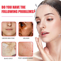 HIVETZ Aobenz Spot Remover for Face,Anti Spot Serum,Dark Spot Correcting Serum,Sun Spot Dark Spot Remover,Age Spot Treatment Face Serum,Skin Whitening Spot and Freckle Remover,Spot Treatment for Face,50ml