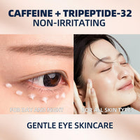 RAZUYEN Under Eye Cream For Dark Circles, Puffiness and Wrinkles, Hyaluronic Acid + Peptide + Caffeine Eye Cream Anti Aging, Hydrating Eye Care, 20ml/0.67 fl oz