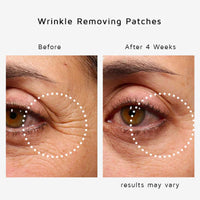 IZBEAUVO 2 Boxes Dissolving Microneedle Eye Patches, Hyaluronic Acid Micro Needle Eye Patches, Microcrystalline Eye Mask, Under Eye Patches For Dark Circles And Puffy Eyes, Hydrate, Firm & Smooth Fine Lines