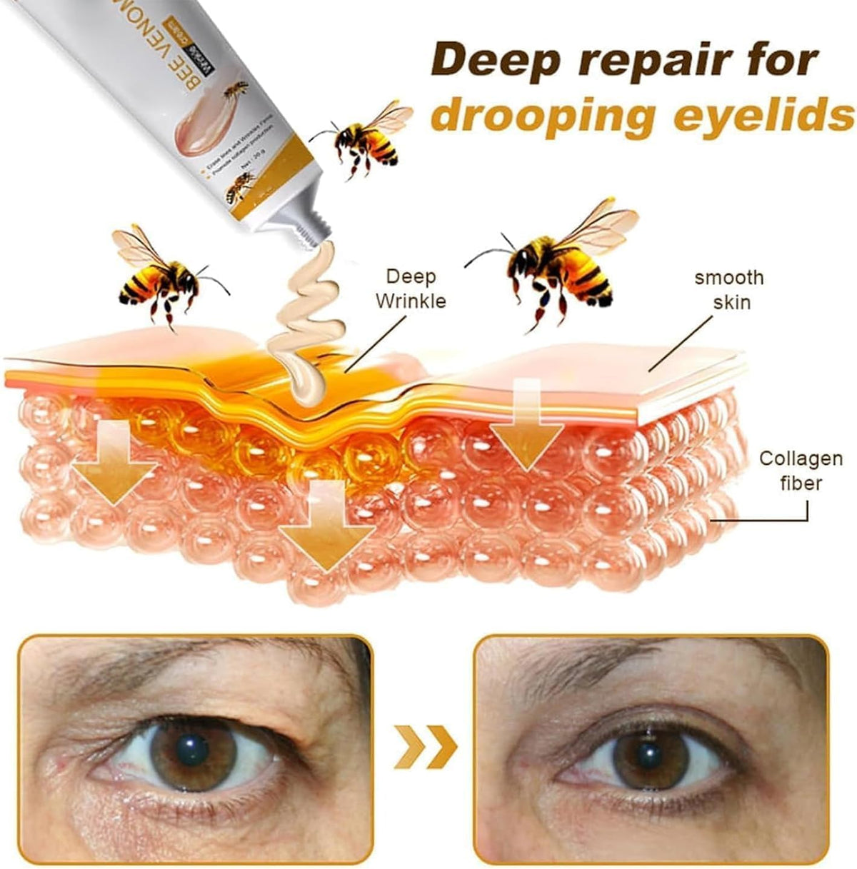 TBLMPNE 2Pcs Furzero Bee Venom Wrinkle Removal Cream, for All Skin Types