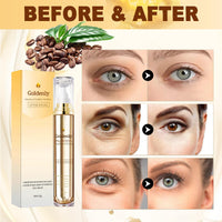 QUIWEN Caffeine Eye Serum, Under Eye Cream for Dark Circles and Puffy Eyes, Day & Night Eye Cream Anti Aging with 360° Massage Ball, Reduce Fine Lines Wrinkles Eye Bags, Eye Roller Cream for Men and Women