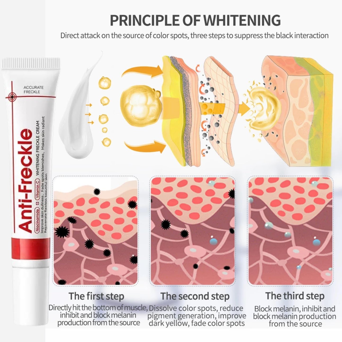 Tianyue Freckle Removal Cream,Anti-Freckle Crea-m- Dark Spot Removal Cream with Niacinamide & Vitamin C,Dark Spot Remover for Face & Body,Whitening Freckl-e Crea-m, Reduces Melasma,Improve Skin Dullness