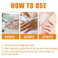 Kojic Acid Underarm Cream,Underarm Whitening Cream,Dark Underarms Treatment,Skin Whitening Body Lotion,Skin Lightening Cream,Skin Care for Armpits, Knees, Inner Thighs, Bikini Areas,Reduce Odor