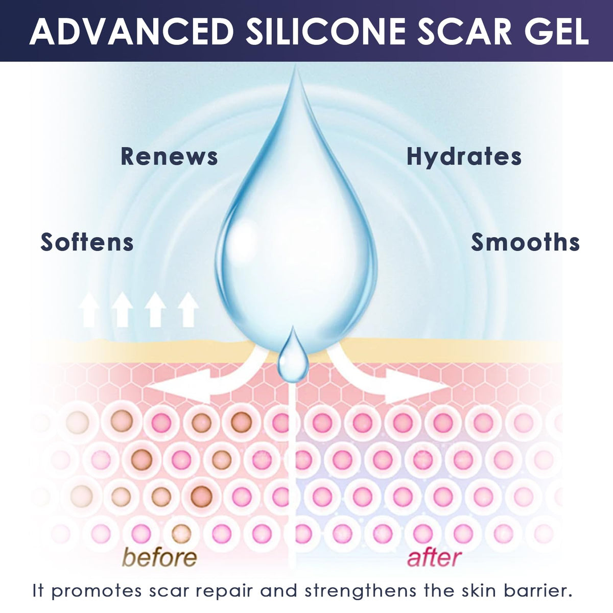 Uheltosly 30g Scar Gel, Scar Cream, Mild and Moisturizing Scar Removal Cream, Stretch Mark Cream, Recovery for Old and New Scars
