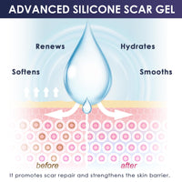 Uheltosly 30g Scar Gel, Scar Cream, Mild and Moisturizing Scar Removal Cream, Stretch Mark Cream, Recovery for Old and New Scars