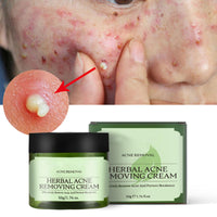 QEUTKEZS Herbal Acne Removing Cream,Professionally Remove Acne Marks,Gently Moisturize,Refreshing & Not Greasy,Improving Sensitive Skin Prone to Acne,Acne Scar Cream & Pimple Remover For All Skin Types