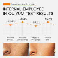 TBeautfave Vitamin C + Turmeric Face Toner | Turmeric Toner for Face | Brightening Facial Toner | Hydrating Toner | Pore Minimizer | Reduce Dark Spots & Acne | Alcohol Free | 100ml