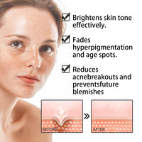 Siyinzu Dark Spot Correcting Glow Serum,5% Niacinamide Serum,Brightening Dark Spot Ser/um,Dar/k Spo/t Remover for Face,Anti-Aging Ser/um,Hydrating Facial Se/rum,Skin Care S/erum for Age/Sun Spots/Acne Marks