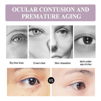 Lutein Eye Essence Oil,Anti-Aging Eye Cream & Serum for Dark Circles, Wrinkles, Puffy E/yes, Men & Women, Vitamin C Treatment,Ey/e Bag Remover, Under Ey/e Roller,Dark Circle Treatment,Anti Wrinkle