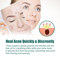 LIDOUK 12mm and 8mm spot patches, acne patches, star shaped, water-based gel patches for acne, blemishes, cyanosis, and facial acne patches (112 patches)