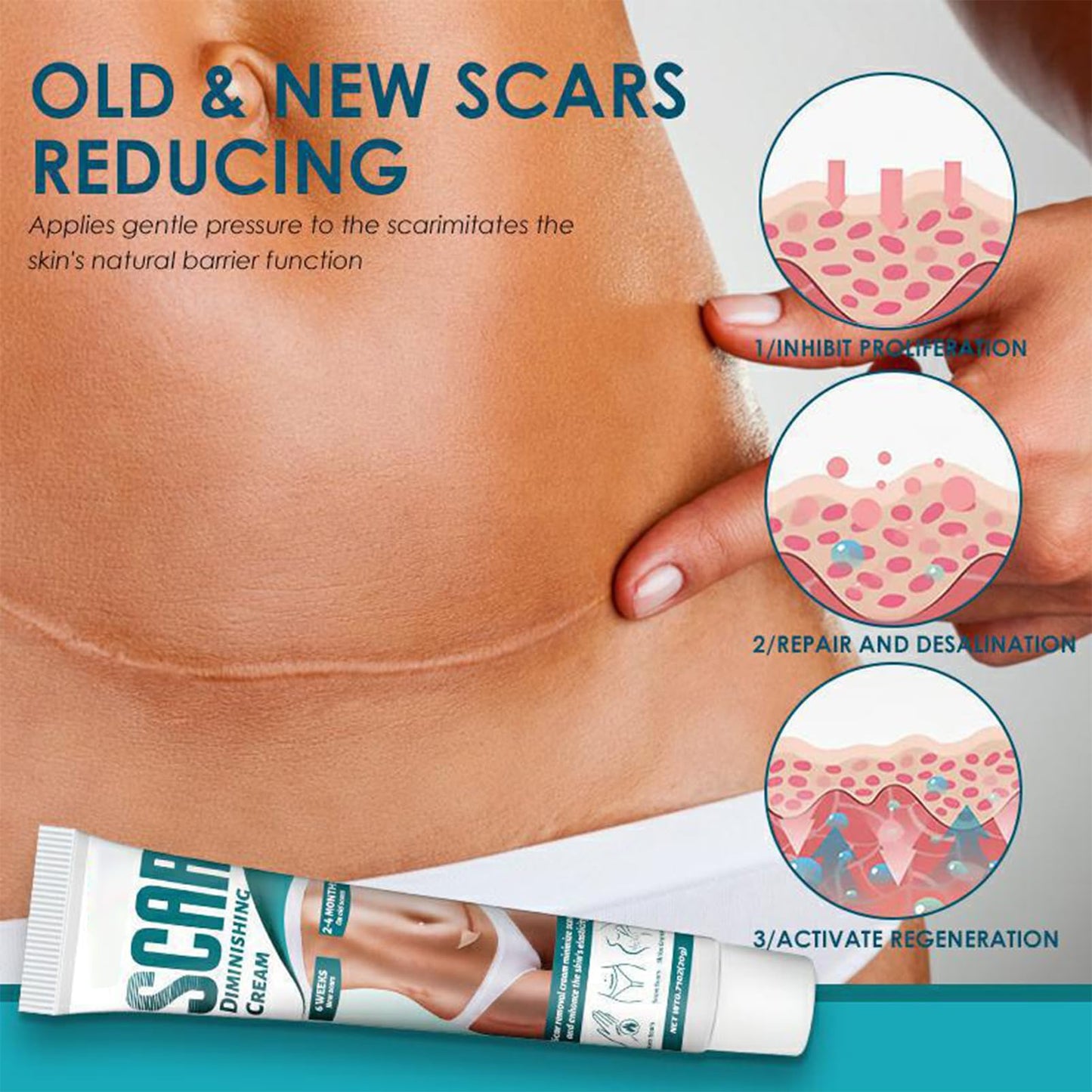 Scar Cream, Scar Removal Cream, Stretch Mark Removal Cream, Scar Erase, Skin Repair Cream for Face & Body Scar, for C-Section, Burns, Stretch Marks, Acne, Surgery, Effective for Both Old and New Scars