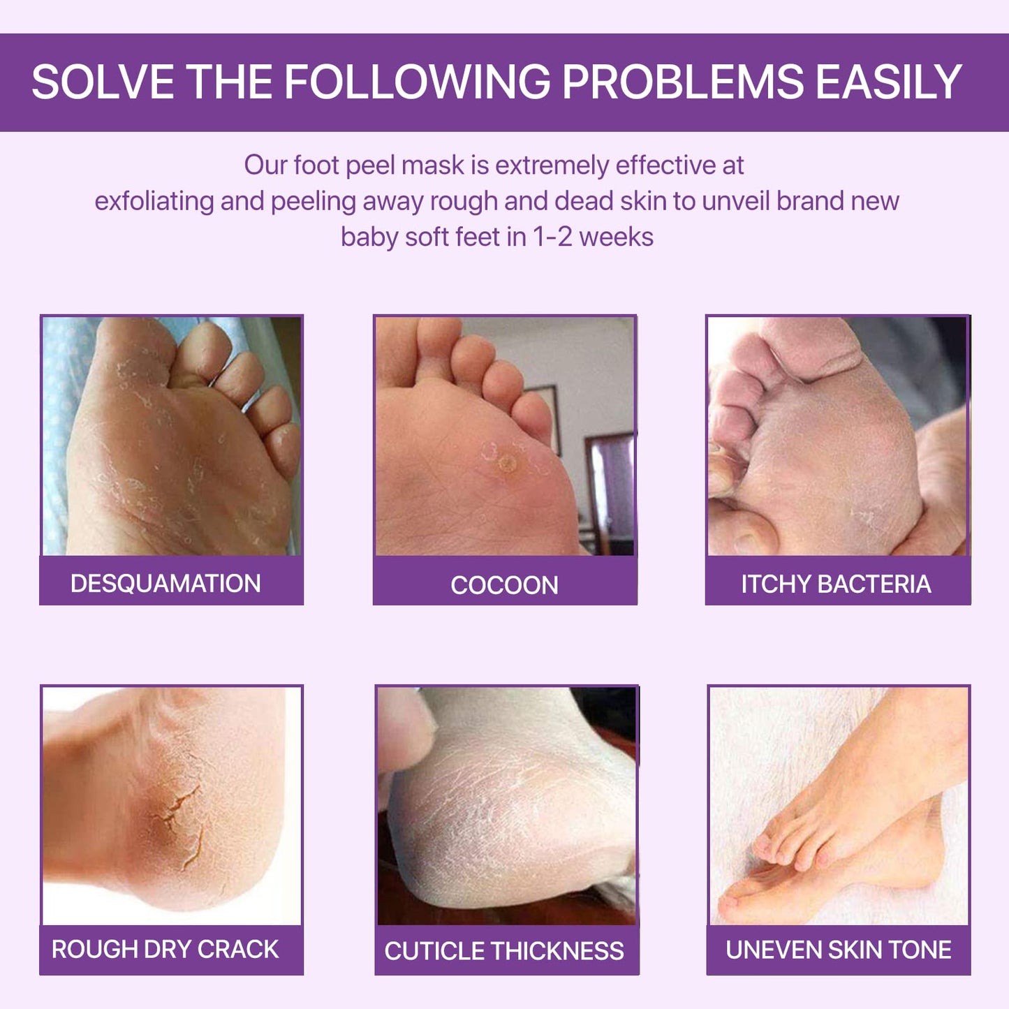 sefudun 3 Pack Foot Peel Mask,Exfoliating Foot Socks Calluses Remover Dead Skin, Aloe Moisturizing Feet Peeling Mask for Dry Skin,Cracked Heels,Foot SPA Socks for Women and Men