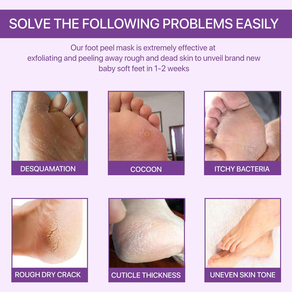 sefudun 3 Pack Foot Peel Mask,Exfoliating Foot Socks Calluses Remover Dead Skin, Aloe Moisturizing Feet Peeling Mask for Dry Skin,Cracked Heels,Foot SPA Socks for Women and Men