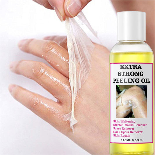 Yellow Peeling Oil - Lightening Exfoliating Dark Skin For Body, Strong Peeling Oil, Skin Peeling Oil For Skin Lightening, Peeling Oil For Skin Brightening Moisturizing, Peeling Solution Dark Skin