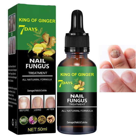 7 Days Nail Fungus Treatment,Ginger Nail Treatment,Fungal Nail Treatment,Toenail Fungus Treatment Extra Strength,Fungal Nail Treatment for Toenails Extra Strong,Nail Repair,Nail Growth Serum,50ml
