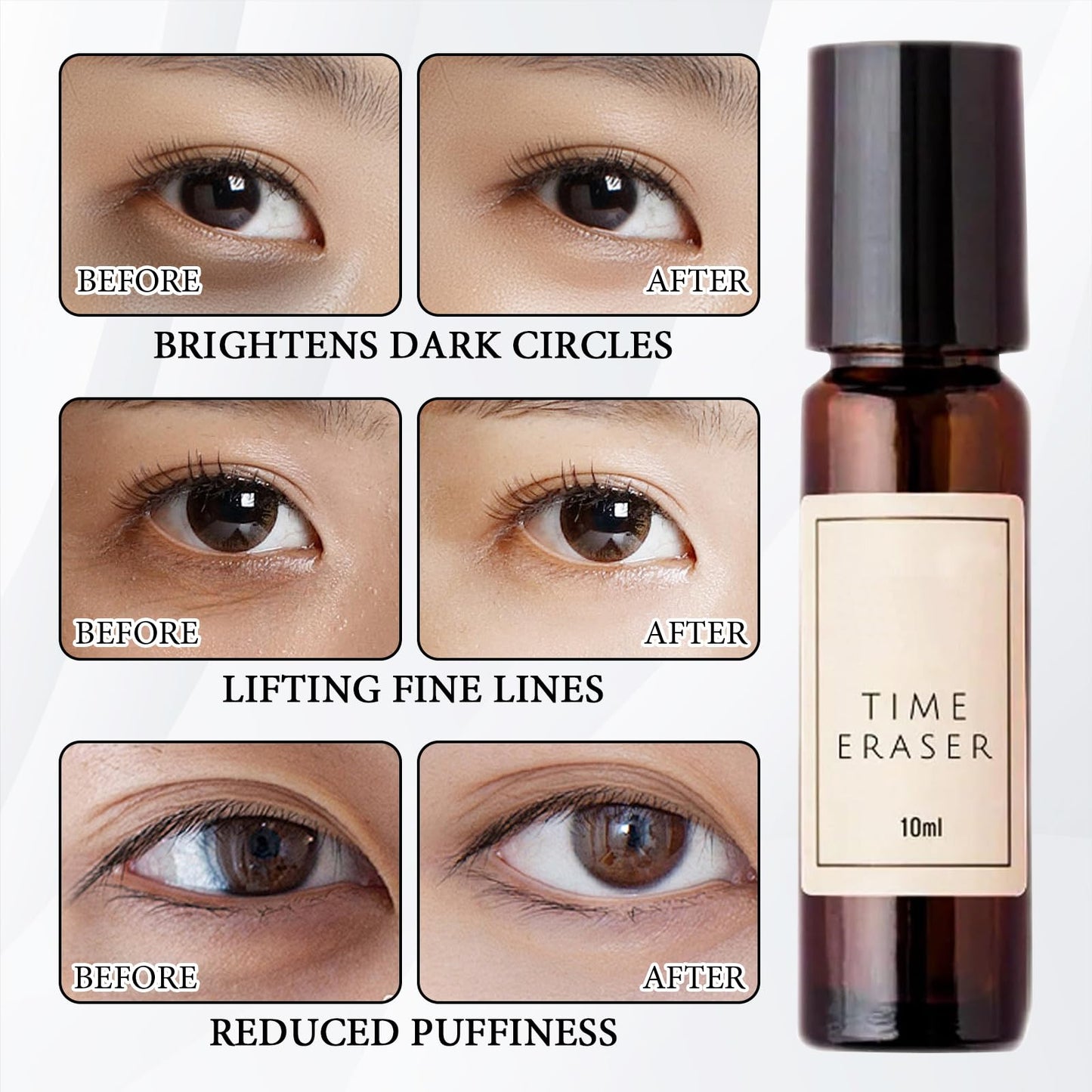 ExcellaElite Zendi Time Eraser 2pcs Rollerball Castor Oil Eye Roller Castor Oil and Frankincense Roller Ball Natural Ingredients Smooth Fine Lines,for Eyes Bags Under Eyes Wrinkles(10ml)