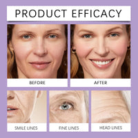 TBeautfave Skin Tightening Cream For Face, Instant Face Lift Cream, Instant Wrinkle Remover with Hyaluronic Acid and Vitamin C, Moisturizes & Reduces Wrinkles, Face Tightening Cream Suitable for All Skin Types