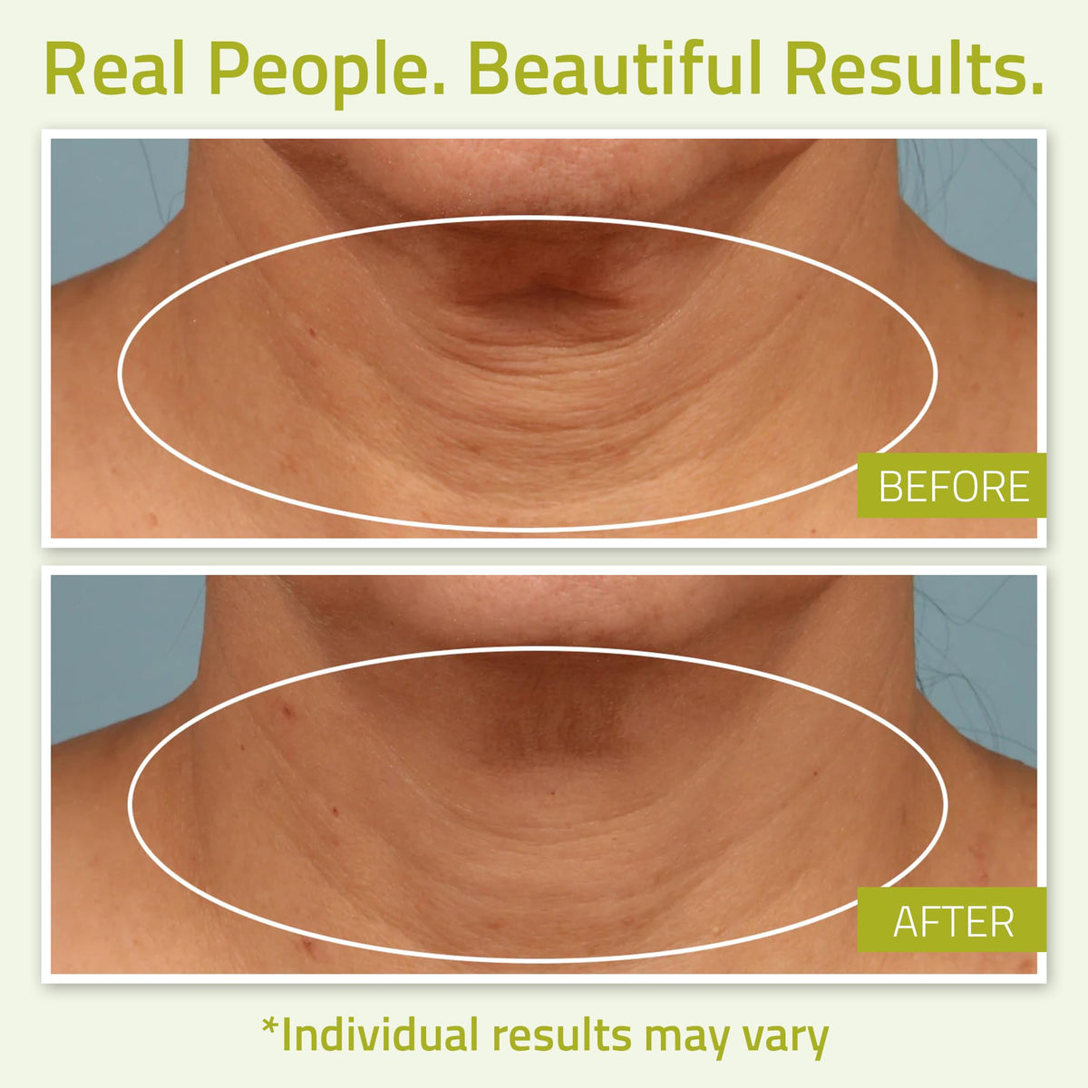 YEOUTH Neck Cream with Vitamin C, Moisturizing Neck Firming Cream for Women and Men, Targeting Decolletage and Double Chin, Cleavage and Chest 120ml