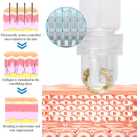 MADGININE Micro Infusion Facial System,Micro Infusion Kit,Beauty Micro Infusion Micro Infusion System Hyaluronic Acid Serum for Face Suitable for All Skin Types (3*Serum+Roller)