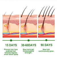 AmiCera Rosemary Oil for Hair Growth, Organic Pure Rosemary Essential Oil, with Derma Roller for Hair, Hair Strengthening for Men Women, Scalp Massage & Nourish, Eyebrow Eyelash Growth Oils, 60ml, 2 Brushes