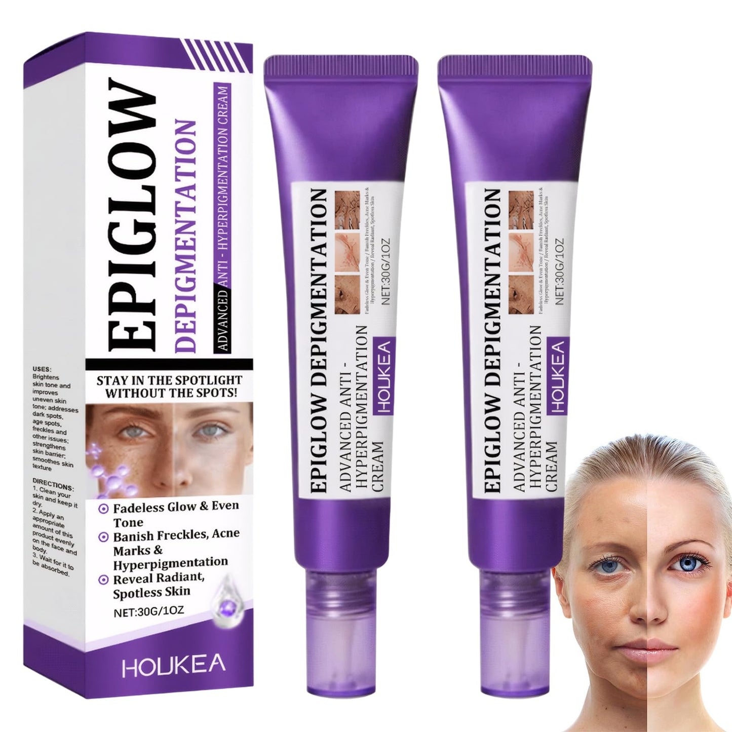 2 PCS Advanced Anti-Hyperpigmentation Cream, Pigmentation Removal Cream Face for Hyperpigmentation, Tightens Skin Suitable for All Skin Types