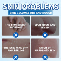 60% Urea Cream - Urea Cream 60 Percent for Feet - Cracked Heel Repair Cream - Ure_a Foot Cream Stick Plus 2% Salicylic Acid For Calluses - Foot Crea_m For Cracked Heels And Dry Skin 1pc