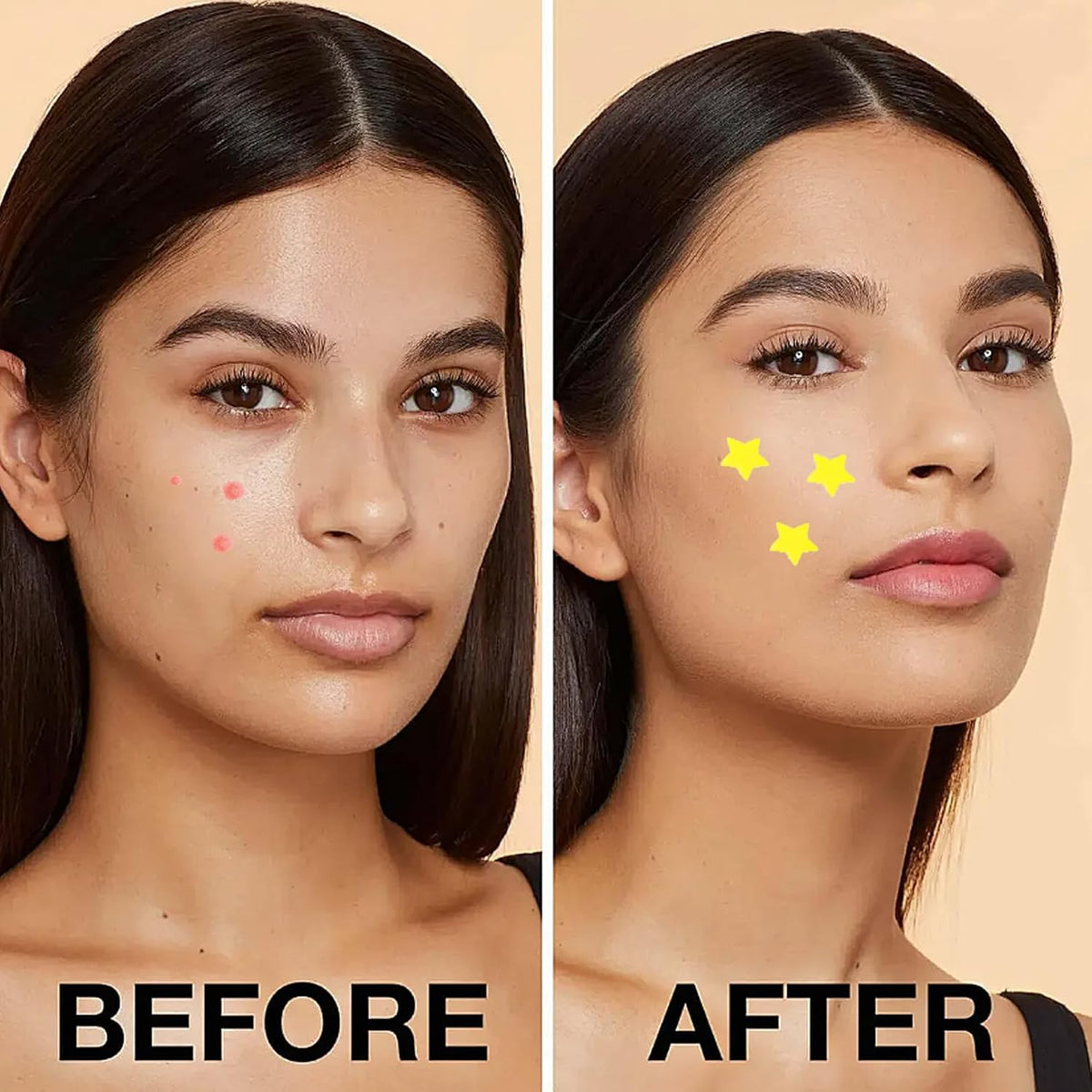 DERDOUT 3 boxes of 3 colors of water-based gel acne patches, absorb liquids and reduce redness and swelling, cute star shaped (32 pills per box)