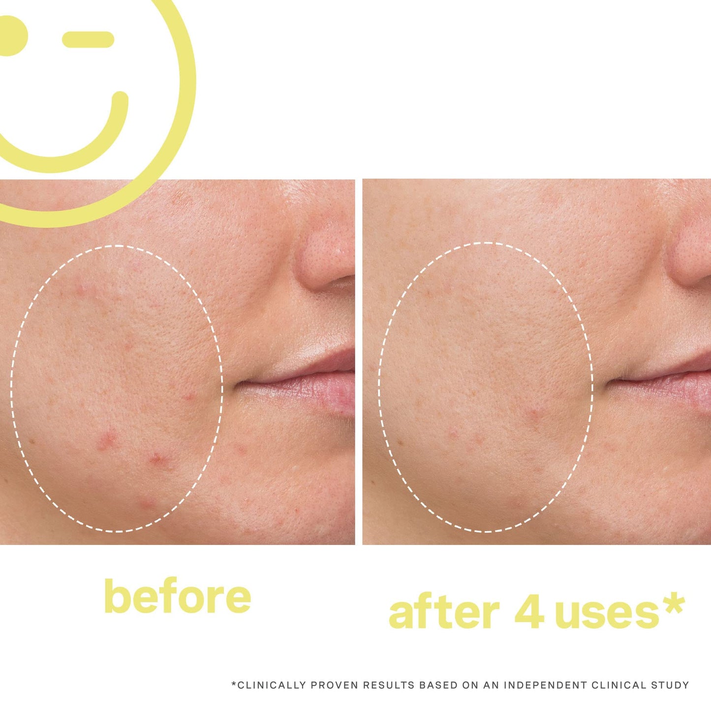 KATE SOMERVILLE MEGA-C™ 30% Vitamin C Brightening Facial