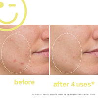 KATE SOMERVILLE MEGA-C™ 30% Vitamin C Brightening Facial