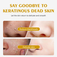 Trendyfave Lemon Peeling Gel, Vita Lemon Face Scrub Exfoliator with Purifying Exfoliating Gel – Vitamin C & Niacinamide for Glowing Skin, Face Exfoliator Scrub for Radiant Skin, Face & Body &Knee (100ml)