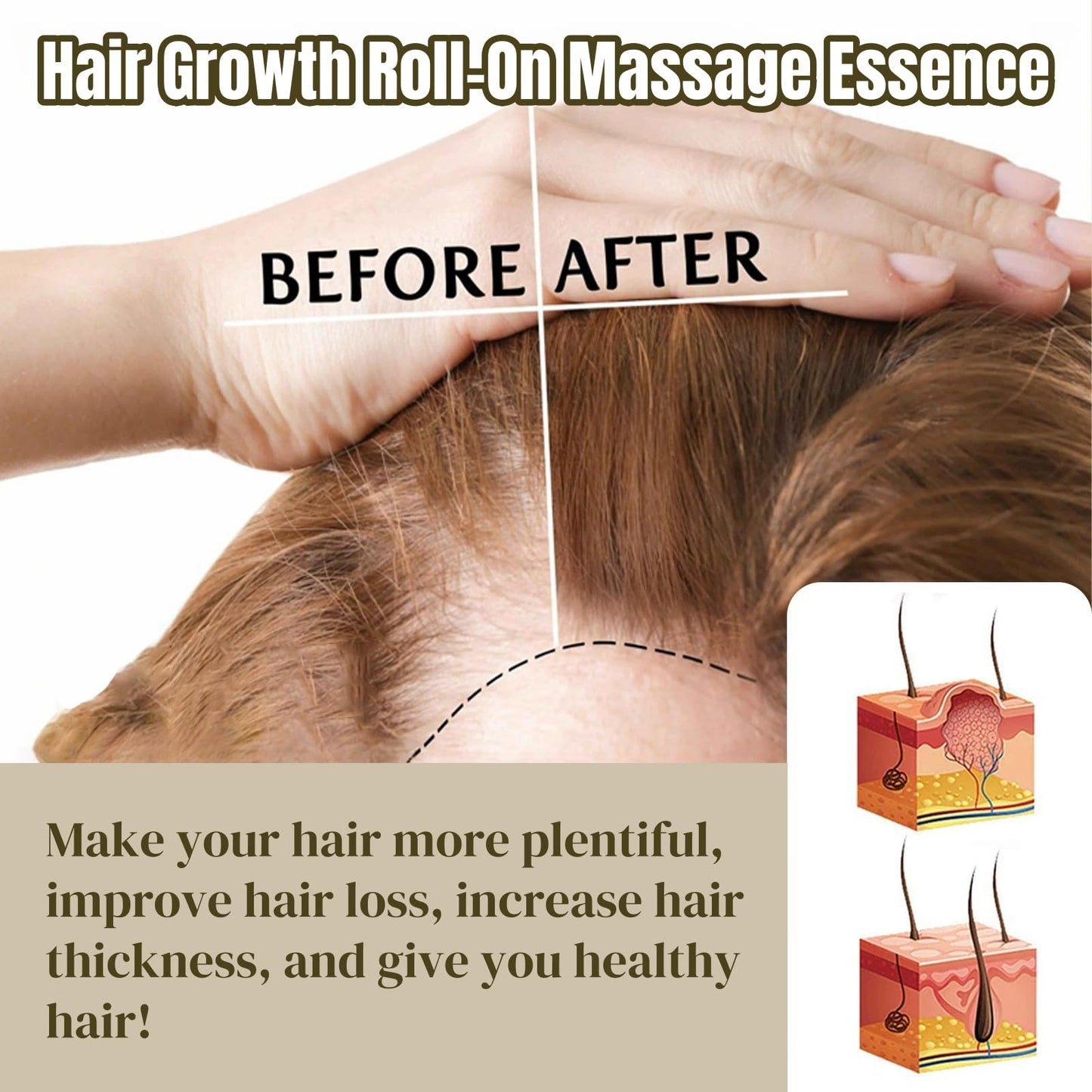 SingHao 2Pcs Hair Growth Roll-On Massage Essence,Anti H/air Loss Serum,Hair Regrowth Treatment,Hair G/rowth Se/rum Roll On,Roller Ball Ha/ir Care Oil,Hair Treatment for Hai/r Loss,Hair Serum for Hair Growth