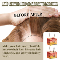 SingHao 2Pcs Hair Growth Roll-On Massage Essence,Anti H/air Loss Serum,Hair Regrowth Treatment,Hair G/rowth Se/rum Roll On,Roller Ball Ha/ir Care Oil,Hair Treatment for Hai/r Loss,Hair Serum for Hair Growth