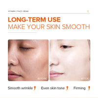 KKwoter Anti-Aging Vitamin C Moisturizer for Face - Day & Night Cream for Women & Men. Brightens & Evens Skin Tone, Boosts Collagen and Reduces Fine Lines. Effective Skin Care Solution