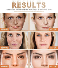 Heyzeibo Seagril-Peptide Wrinkle Reducing Cream Contains 12 Different Natural Peptides, 10 X Peptide Wrinkle Reducing Cream Anti Wrinkle, All Natural Ingredients