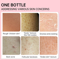 Grospe Skin Exfoliating Repair Cream, Chicken Skin Care Cream, Strawberry Legs Treatment Body Cream, Hydrating Moisturising Refreshing Skin Fragrance Repair Body Lotion 50g