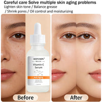 SEFUSON Vitamin C Serum Face, With Hyaluronic Acid, Vitamin E,20% Vitamin C for Anti-wrinkle, Dark Circle, Restore & Boost Collagen, Firming skin (30ML)