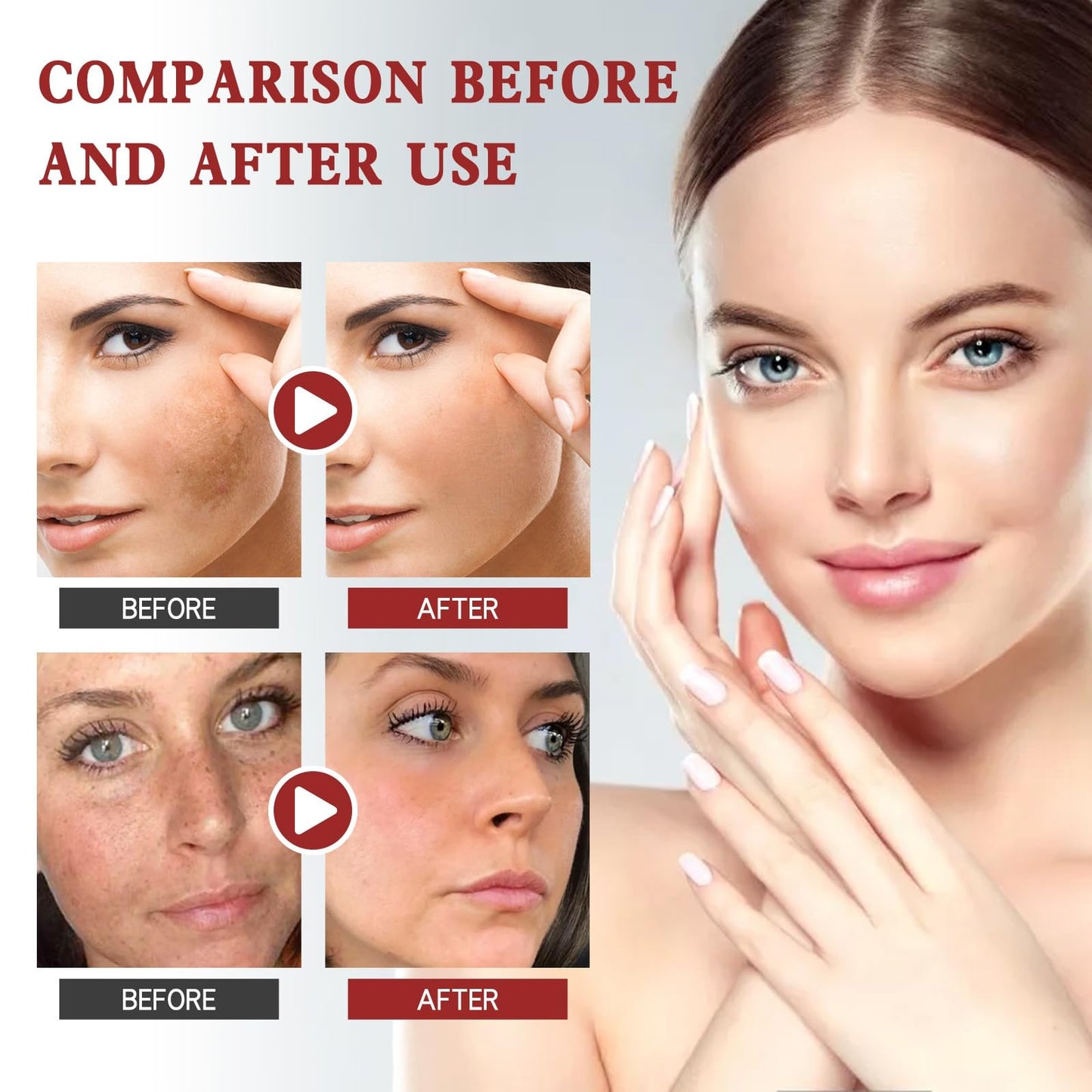 Whitening Freckle Cream,Dark Spot Remover for Face,Freckle Removal Cream,Acne Scar Removal Treatment Crea/m,Skin Lightening Cre/am for Dark Skin,Dark Spot Corrector Cr/eam,Spot C/ream for Women & Men